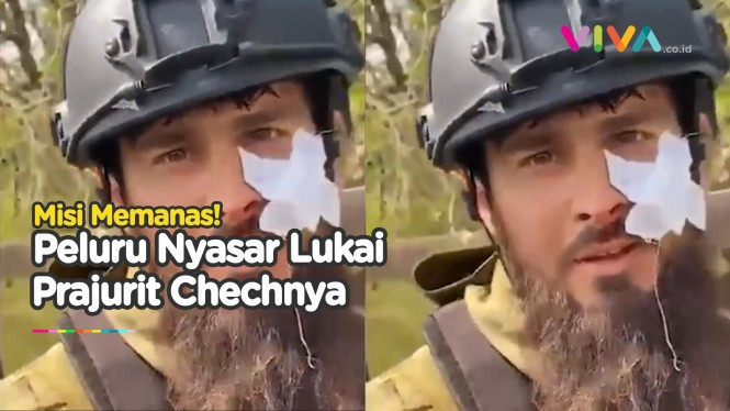 Peluru Menancap di Pipi Prajurit Chechnya