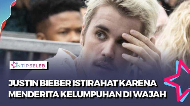 Justin Bieber Alami Kelumpuhan Wajah Sebelah, Kenapa?
