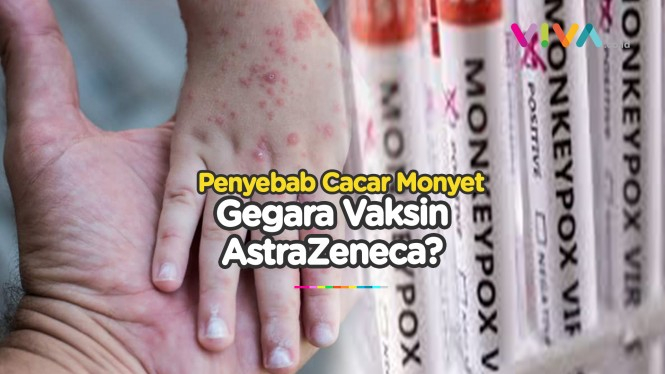 Cacar Monyet Efek Samping Vaksin AstraZeneca, Beneran?