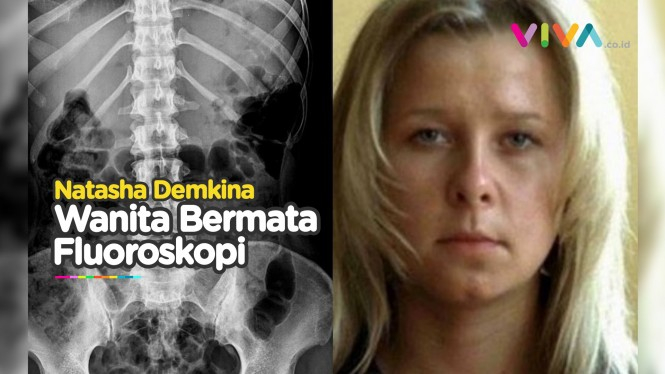 Wanita Rusia Dengan Mata Berkekuatan X-Ray