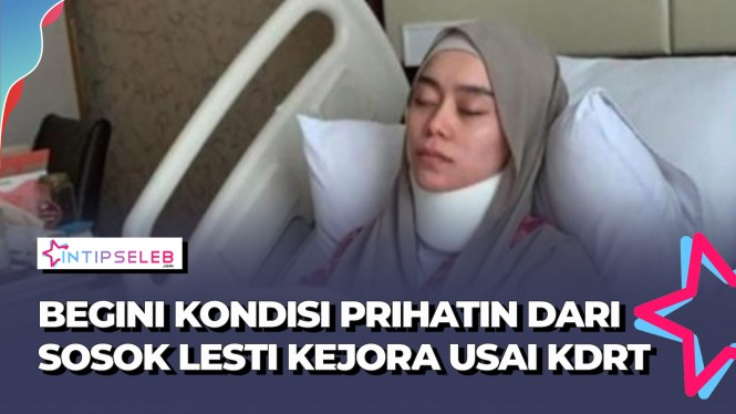 Usai Dianiaya Suaminya Lesty Kejora Pakai Penyangga Leher Vlixid 7000