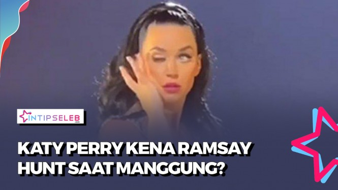 Penyebab Mata Kanan Katy Perry Menutup Sendiri Saat Manggung