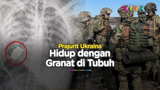 Nasib Prajurit Ukraina Hidup dengan Granat Aktif di Tubuh
