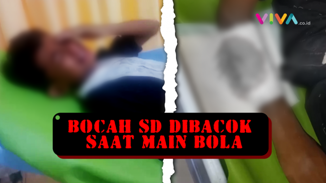 TRAGIS! Bocah SD Dibacok Senior saat di Pondok Pesantren