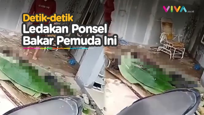 Tragis! Ponsel Meledak, Seorang Pemuda terbakar saat Tidur.