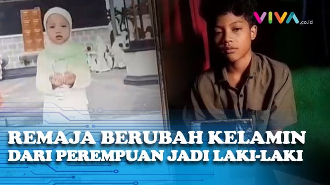 Kronologi Perempuan di Bogor Berubah Kelamin Jadi Laki-laki